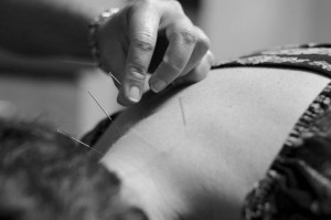 Acupuncture Therapy To Help With Mesa Whiplash Injuries 