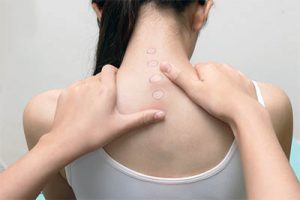atlas chiropractic treatment in mesa az