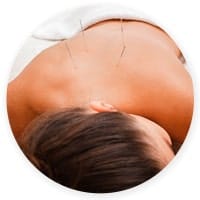 mesa-chiropractic-acupuncture-treatments Acupuncture Treatments in Mesa